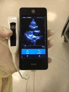 Handheld Ultrasound Scan
