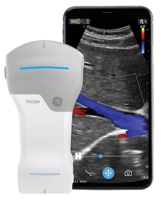 Ultrasound Therapy Handheld Unit for Pain Relief Healthcare World