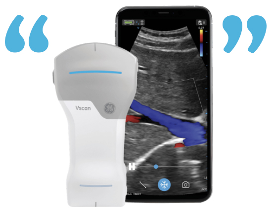 GE HealthCare Handheld Ultrasound testimonial image