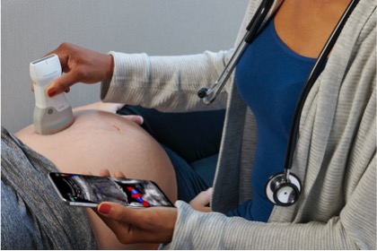 GE HealthCare Handheld Ultrasound Side image