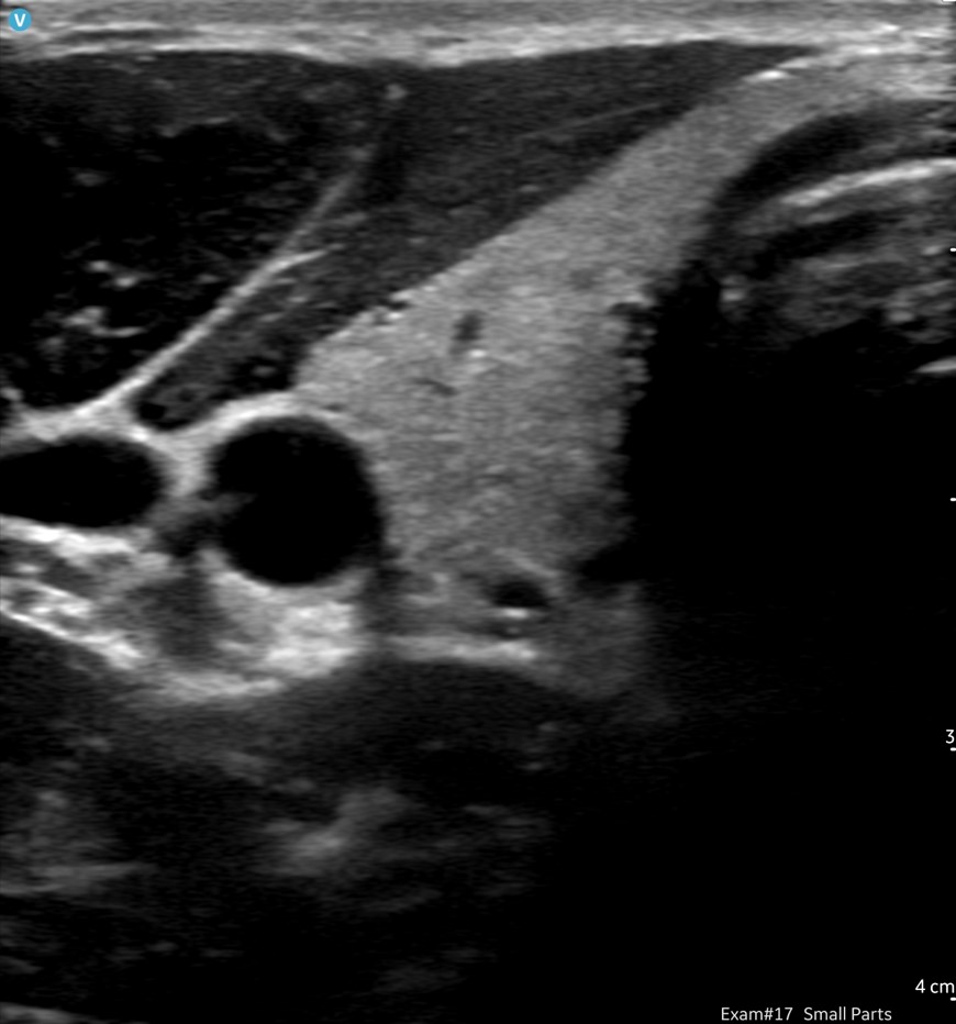GE HealthCare Handheld Ultrasound image